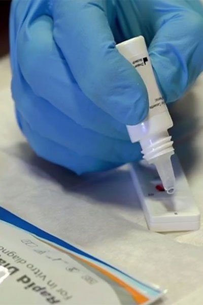 Test Rapido COVID-19